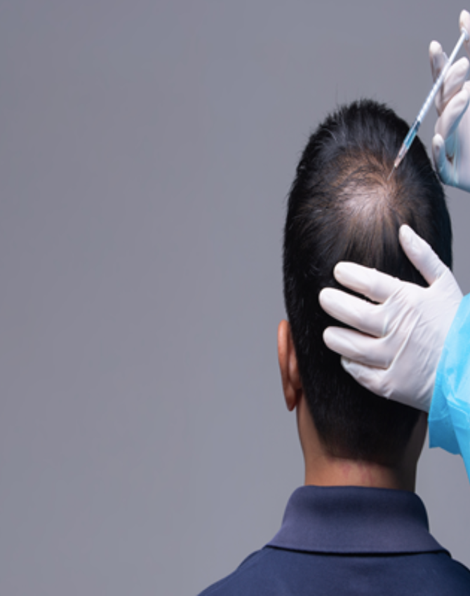 GFC Hair Treatment – Revolutionary Hair Regrowth Therapy