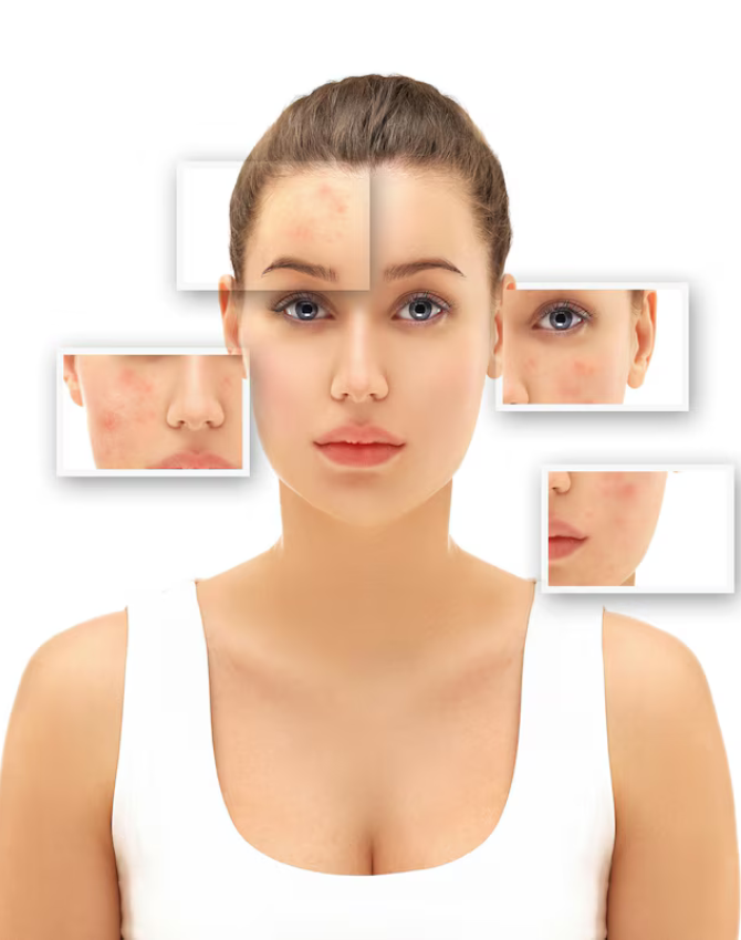 anti-ageing skin treatment near me